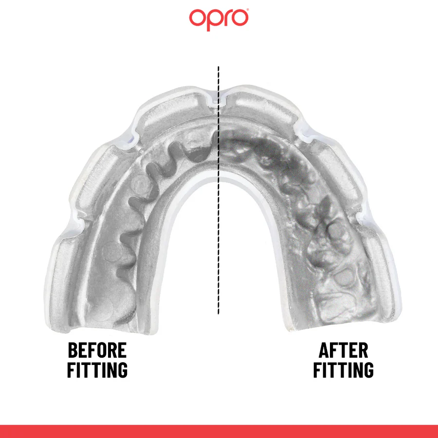 Protector bucal Opro Instant Custom-Fit para aparato Negro-blanco  - Image 2